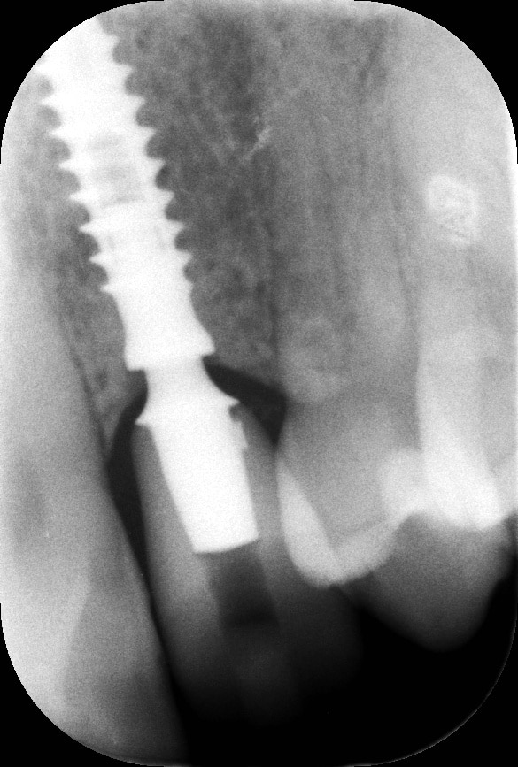 NOVIA^GIOVANNA_ctr 2